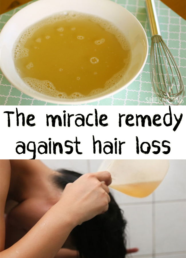 3 Hair Remedies You Should Not Miss